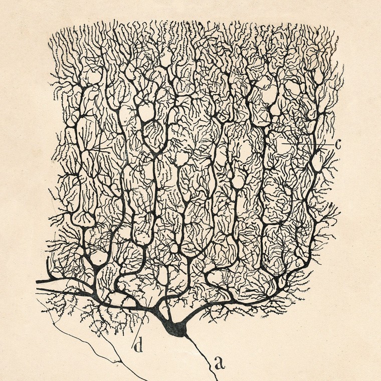 Célula de Purkinje